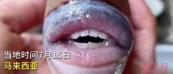 网传长着人类牙齿和嘴唇的怪鱼图片