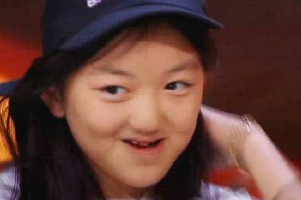 李嫣兔唇原因有三 怀孕喝酒导致畸形的吗