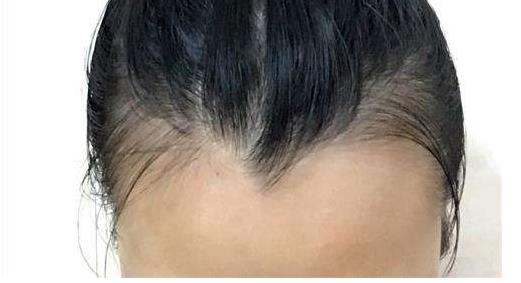 什么是美人尖:长美人尖有什么好处及命运(美人尖图片) 什么是美人尖:长美人尖有什么好处及命运(美人尖图片)