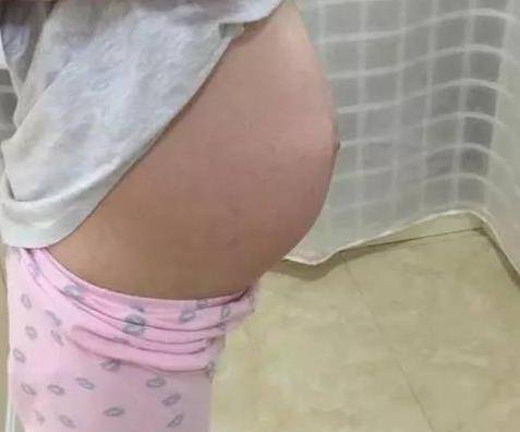 什么提示你怀了男宝宝：判断生男生女的小妙招