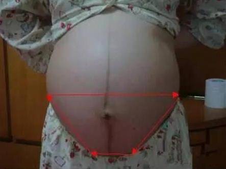 什么提示你怀了男宝宝：判断生男生女的小妙招