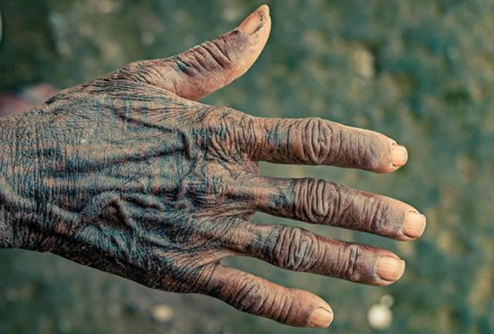 纹身老了后的恶心图片：确实有那么一点点不好看