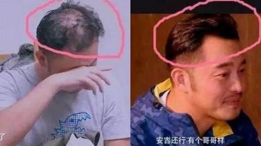 沙溢秃顶后又不秃顶了头发忽多忽少好奇怪!沙溢戴假发看不出来啊