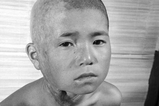 福岛核泄漏后变异女人什么样子