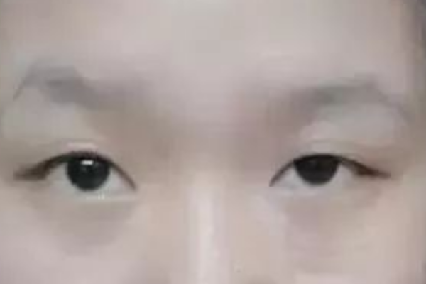 眉毛太少了怎么变浓密变黑，化妆方法和食疗方法了解一下！