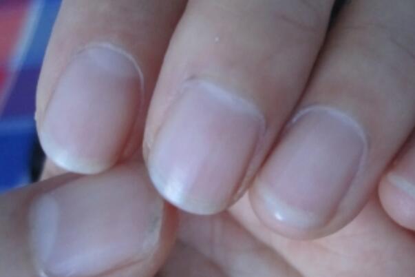 指甲里的月牙代表什么意思代表身体出现什么问题吗怎么看？