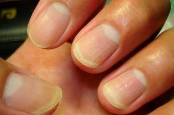 指甲里的月牙代表什么意思代表身体出现什么问题吗怎么看？