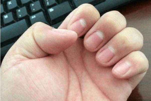 指甲里的月牙代表什么意思代表身体出现什么问题吗怎么看？