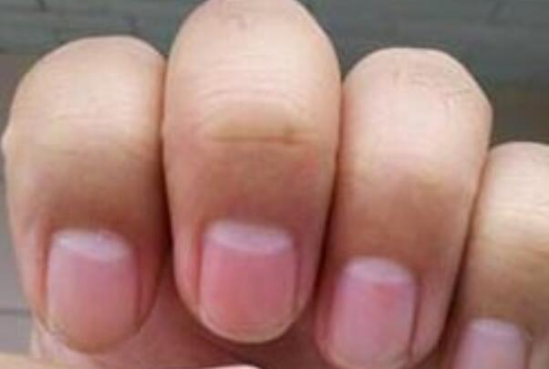 指甲里的月牙代表什么意思代表身体出现什么问题吗怎么看？