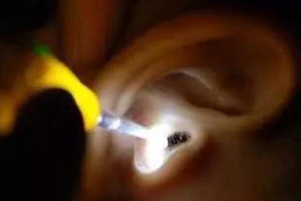 耳朵里进了小飞虫怎么办怎么处理，怎么判断虫子到底有没有钻进耳朵