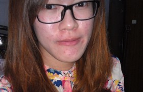 脸上痘痘怎么除?张况雅30天成功去痘故事(绝对真实有用)