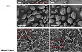 超级真菌感染后有什么症状怎样传播的如何治疗哪些地方有人被传染