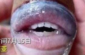 马来西亚发现长着人类牙齿和嘴唇的怪鱼是什么鱼是真的假的ps的吗