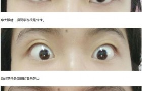 死鱼眼是什么样子的真人图片，死鱼眼的人是天生的吗什么性格