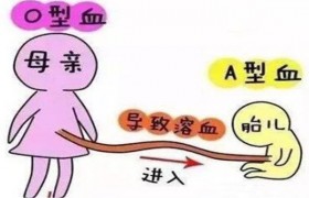 a型血和o型血的父母生出来的小孩是什么血型的是会得溶血症吗