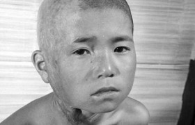 福岛核泄漏后变异女人真实照片，核辐射的危害人和动物变异后图片