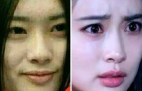 孟子义旧照，孟子义整容过吗以前的照片是怎样的？