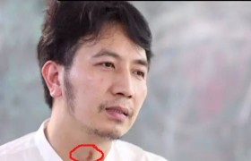 林生斌脖子上的吻痕怎么回事是谁的，林生斌和现任老婆是怎么认识的