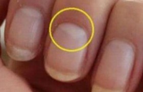 指甲里的月牙代表什么意思代表身体出现什么问题吗怎么看？