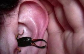 耳朵里进了小飞虫怎么办怎么处理，怎么判断虫子到底有没有钻进耳朵