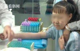 15岁少女长60岁脸是怎么回事？辽宁省黑山县得了什么早衰病？